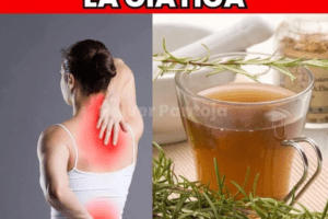 Remedio Natural para Aliviar el Dolor del Nervio Ciático 🌿🦵