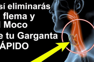 4 Remedios Caseros Eficaces para Eliminar el Moco y la Flema en la Garganta, Sinusitis y Rinitis