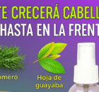 Cabello hasta en la fronte.