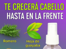 Cabello hasta en la fronte.
